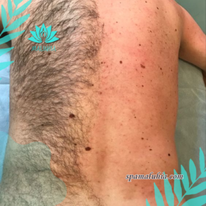 Depilación de Espalda a domicilio - depilación cera e hilo - Maluhia SPA